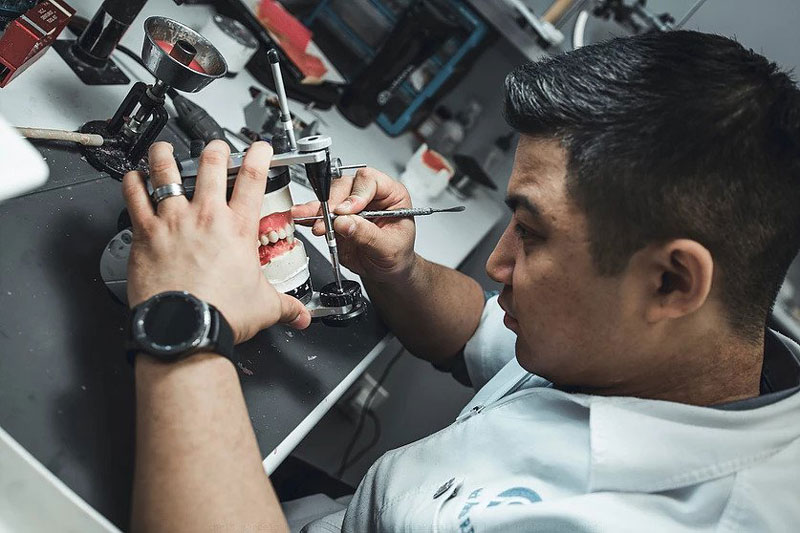Full dentures setup in New Westminster